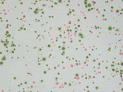 Enameled Metal Splatterware Platter